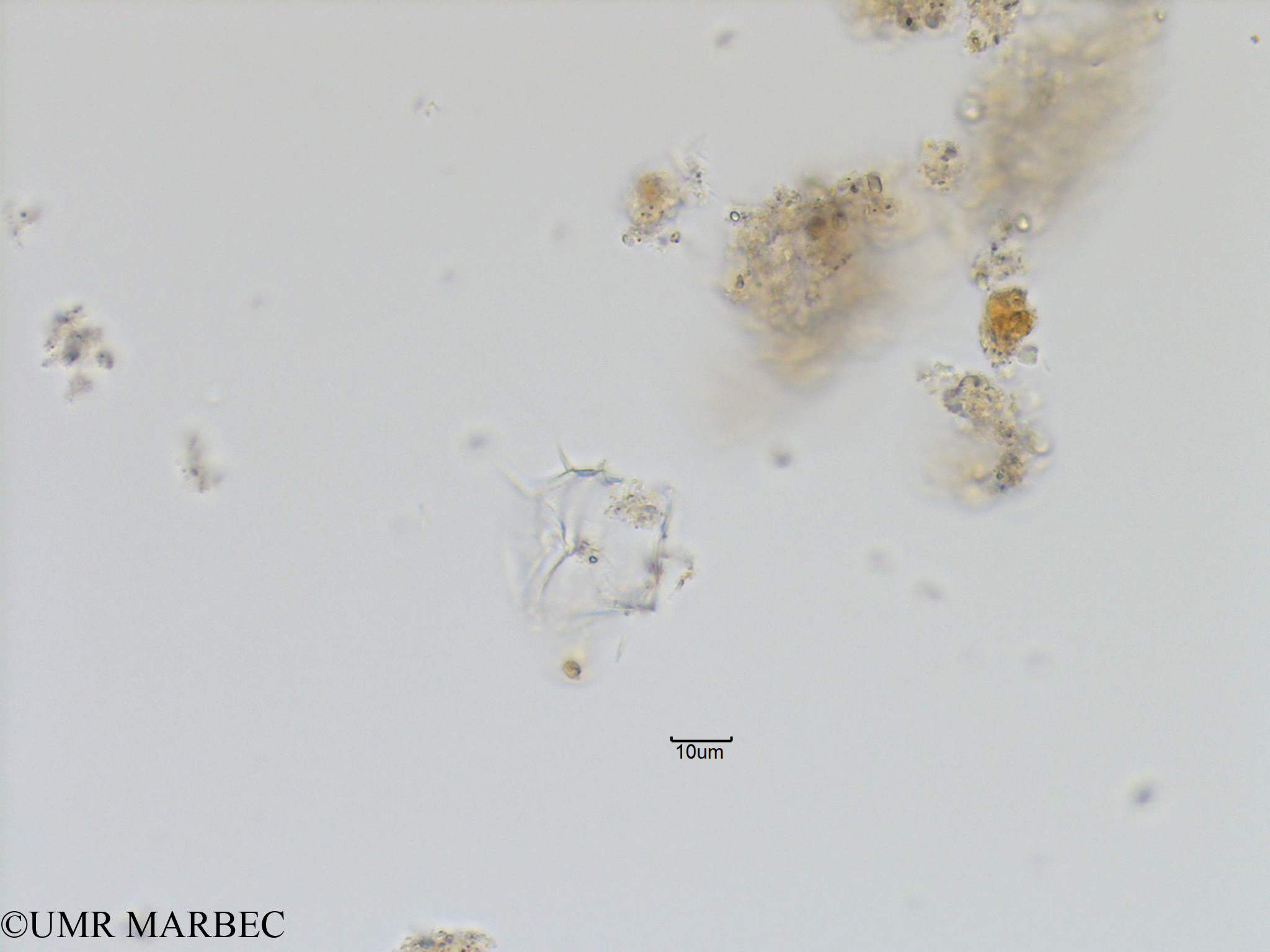 phyto/Bizerte/bizerte_lagoon/RISCO November 2015/Protoperidinium quinquecorne (Lagune_T1_C_Gonyaulax gde epine-11).tif(copy).jpg